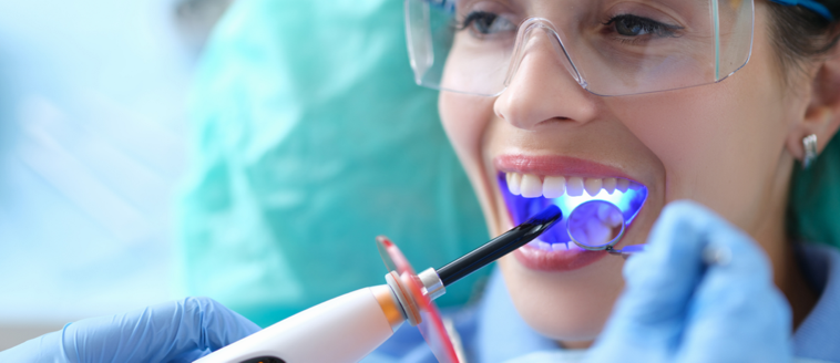 composite fillings