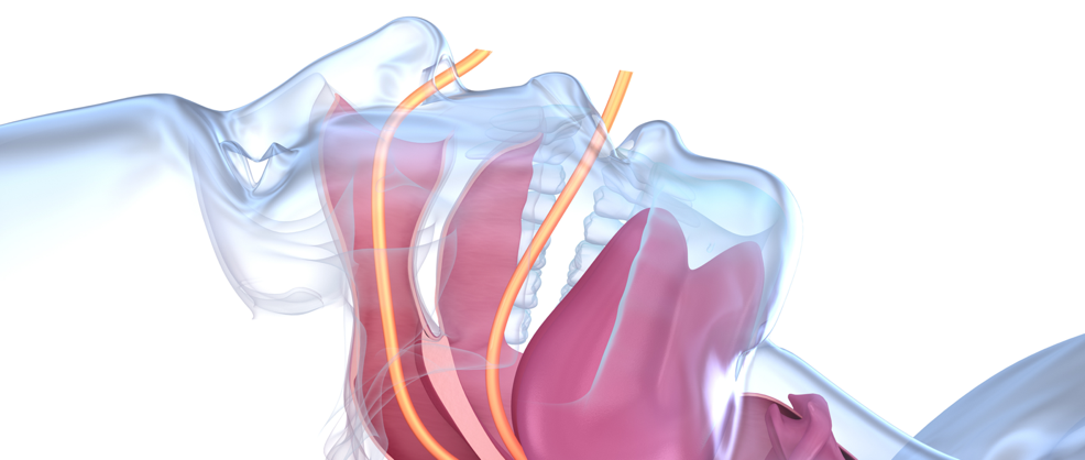 airway therapy